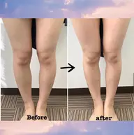 脚集中コース🌟 筋膜の癒着改善◎ 浮腫とり👠【筋膜リリース】