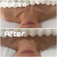 【上半身彫刻メソッド✨】デコルテを美しくデザイン🌿不要な重みを流し、スッキリとした理想のラインへ