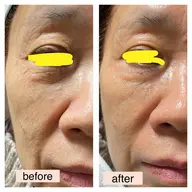 お肌を若返らせたい方に❤️いくつになってからでも変わります✨お任せください‼︎極上フェイシャルマッサージ✨