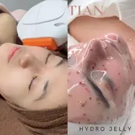 【美肌フォト＋ハイドロジェリーマスク】シミケア・くすみケア・毛穴ケア♡フォト後の鎮静と保湿のパック付き♡