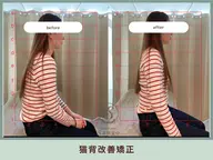 猫背改善矯正