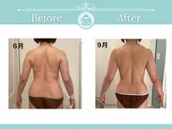 【全身痩身】バストを残してダイエット（機械付）⚫︎60分※すぐ予約のみ【1日2名限定OPEN記念モニター様】