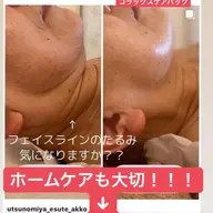 お試し　スタンダード＋エイジングケアコース　　　　　　　　肩のマッサージしっかり　お顔も小顔　リフトアップするコースです