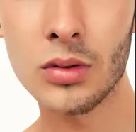 【メンズ脱毛】メンズ脱毛NO.1👱‍♂️お顔脱毛・1番気になる頬骨下からアゴまでをスッキリ脱毛❗️毎日の髭剃りから解放