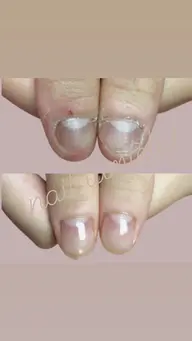 🍀毎週土曜日限定🍀深爪脱脚💅ネイルしながら深爪育成が出来る【初回体験・オフあり】無料で好きなカラーが選べる