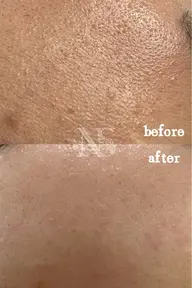 【人気No.1】【毛穴・肌質改善】肌管理フェイシャル◎80分　¥10560（税込）