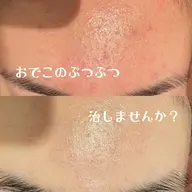 【ブライダルメニュー💍🤍】前撮りや結婚式に向けてイオンパックでのケアお任せください✨