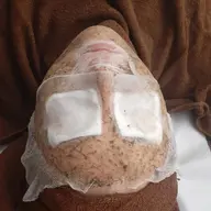 ⭐お得コース⭐　3回チケット　ハーブピーリング🌿　ハードコース