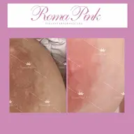 ローマピンク【バスト】モニター特別価格40%OFF