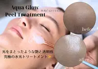 【贅沢トリートメント】水光ピールトリートメント