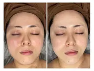 【新規女性/くすみが抜ける透明感ケア】ハリつや光フェイシャル体験¥6600