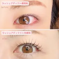 まつげパーマ➕ラッシュアディクト1本セット