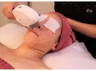 お顔すっきり脱毛