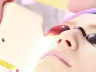 【本格美肌】ニキビケアに◎フォト美顔コース体験60分