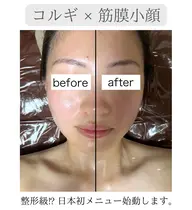 【日本初導入❤️‍🔥】コルギ×パワーレメディで3D小顔矯正💆🏻‍♀️✨速攻で整形級の変化に🥹