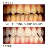 【U24ホワイトニング】🌸20分×6回照射🌸