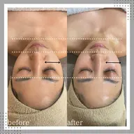 【小顔矯正】スペシャルコース90分(お仕上げはパック/マッサージクリーム付き)