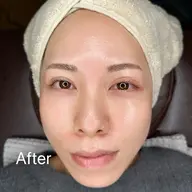 ツル肌体験🌸全顔フェイスワックス✨¥7,500→¥6,000