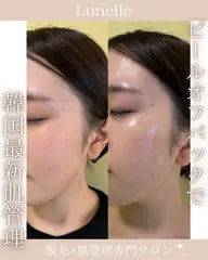 【忙しい方にオススメ】韓国水光肌ピールオフパック管理30分¥2,200