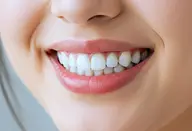 【コスパ最強★定額プラン♪】1ヶ月通い放題 強力セルフホワイトニング¥11,000