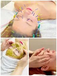 リピーター様✨【3Dリフト美容鍼＋ハーブピーリング＋小顔調整アロママッサージ首肩背中オイル付き】幹細胞美容液付き