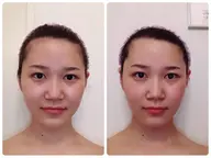 顔+デコルテ＋ヘッドセラピー(ツールなし)