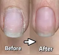 清潔感UP!ウォーターケア+爪磨き ¥2,980爪の形整え+甘皮ケア+爪磨き時間:約30分📌平日15時まで/男性OK