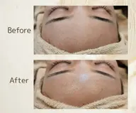 【学割U24】つるすべフェイスシェービング