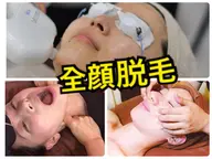 【ご褒美エステ】全顔脱毛＋毛穴洗浄＋小顔コルギ＋角質取り＋美白パック