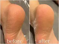 【minimo限定】ガサガサ卒業✨フット角質ケア+膝下マッサージ50分