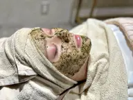 【肌は生まれ変わる】REVIハーブピーリング🌹で導く素肌美。毛穴💎ニキビ🌿皮脂抑制🪞美肌作り✨ダウンタイム無し