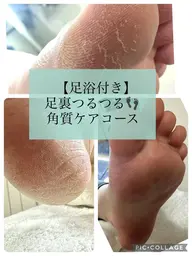 【フットケア足浴付】 足裏つるつる 角質ケア1hコース　5500円