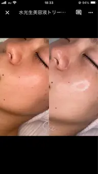 最強ツヤ肌☆水光生美容液ピーリング✨60min