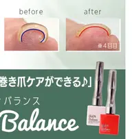 巻き爪ケア☆巻き爪でお困りの方必見です!!色はクリア色になります。1爪の料金になります。フット・ハンドの巻き爪OK🙆