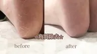 角質除去⭐︎甘皮周りウォーターケア⭐︎フットバス付き⭐︎