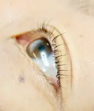 似合わまつ毛カール