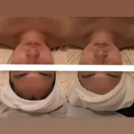 【透明感×小顔】ミニモ限定特別メニュー‼️全身トータルケアエステ💆🏻‍♀️🫧 乾燥はもちろん、むくみもすっきり✨