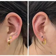 ⑭ 《👂️悩みに寄り添う耳つぼジュエリー》　MAX 20箇所🎀💎