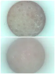 【黒ずみ悩みの方必見】毛穴吸引～デコルテ・首・ヘッドのほぐし付き60分+カウンセリング10分