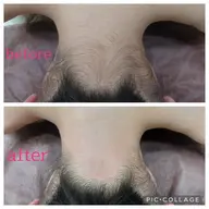 【女性】フェイシャルワックス＋うなじ＋鼻毛