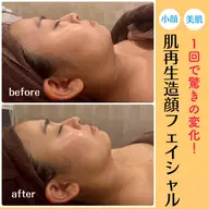 【韓国式肌管理🎀】ララピール超え✨️徹底リフトアップ➕お肌の土台から肌細胞を整えお肌の育成💖美肌と小顔が一度に️🫧