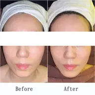 【引き上がる小顔トリートメント】