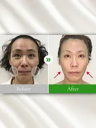 【ミニモ限定🌸】小顔整体コルギ1000円🌱全国50店舗記念キャンペーン✨