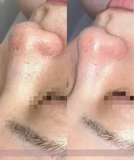 【美白|シミ|くすみ】facial 90min