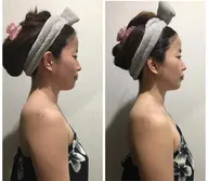 和歌山で当店のみ💎DDフェイシャル✨デトックス小顔＋ドレナージュ美肌💓未体験の小顔,美肌と癒し✨毛穴ケア,骨格矯正✨