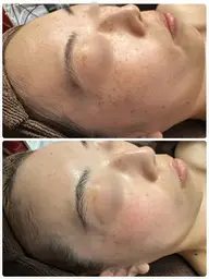 🥇肌再生スペシャル全てのお悩みに対応