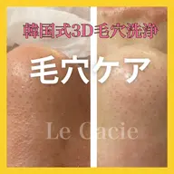 韓国3D毛穴洗浄★小鼻の黒ずみ、毛穴目立ちに！ニュルっとスポッと皮脂を除去します