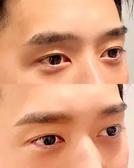 眉カット、眉ワックス脱毛