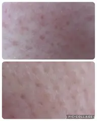 新規の方限定！人気No.1 お肌引き上げコース