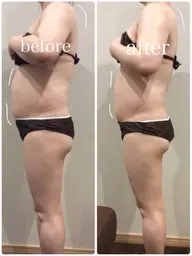 ミニモ限定!【計90分】腸タイプカウンセリング30分+オーダーメイド腸もみ60分